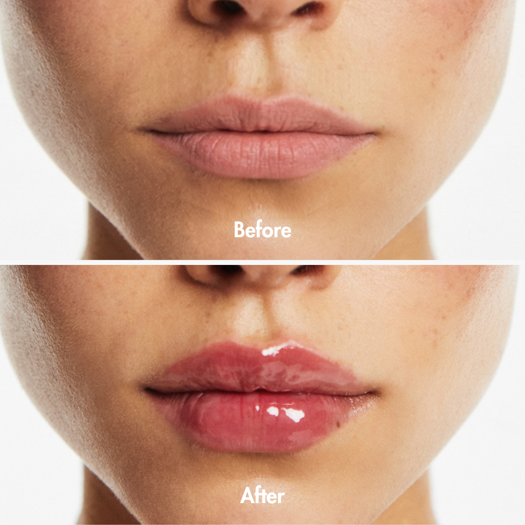Extreme Lip Plumper
